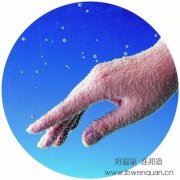 为什么要选择连邦温泉科技的高浓度碳酸泉？
