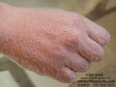 碳酸泉是什么？碳酸温泉设备为什么广受文旅度假康养项目的欢迎？